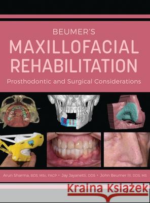 Beumer's Maxillofacial Rehabilitation: Prosthodontics and Surgical Considerations Arun Sharma Jay Jayanetti John, III Beumer 9781495619755 Foundation for Oral-Facial Rehabilitation
