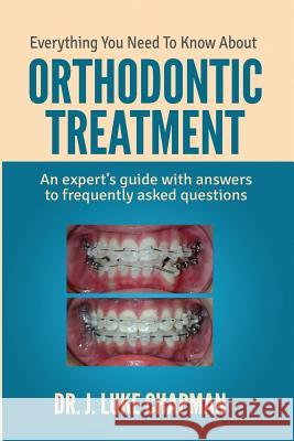 Everything You Need To Know About Orthodontic Treatment: An expert's guide with answers to frequently asked questions Chapman, J. Luke 9781496036100 Createspace