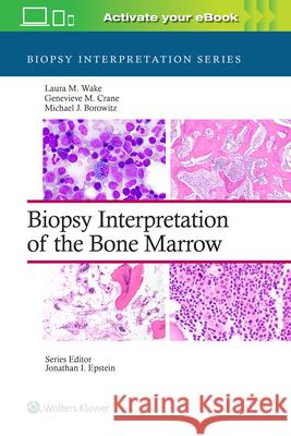 Biopsy Interpretation of the Bone Marrow Wake, Laura M. 9781496300591 LIPPINCOTT WILLIAMS & WILKINS