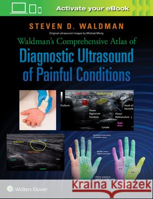 Waldman's Comprehensive Atlas of Diagnostic Ultrasound of Painful Conditions Steven Waldman 9781496302892 LWW