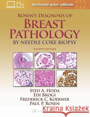 Rosen's Diagnosis of Breast Pathology by Needle Core Biopsy Syed A. Hoda Paul Peter Rosen Edi Brogi 9781496307255