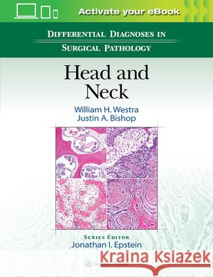 Differential Diagnoses in Surgical Pathology: Head and Neck William H., MD Westra Justin Bishop 9781496309792 LWW