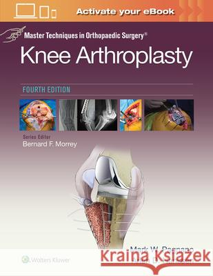 Master Techniques in Orthopedic Surgery: Knee Arthroplasty Mark W. Pagnano 9781496315052