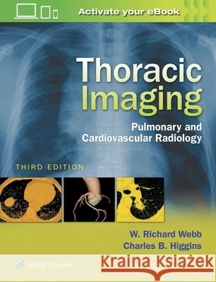 Thoracic Imaging: Pulmonary and Cardiovascular Radiology W. Richard Webb Charles B. Higgins 9781496321046 LWW