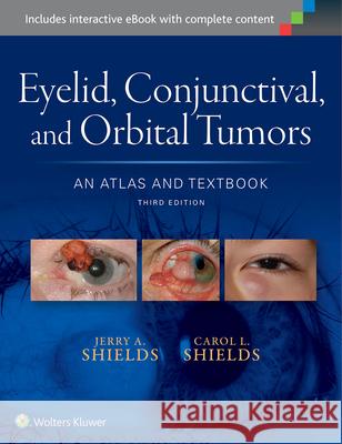 Eyelid, Conjunctival, and Orbital Tumors: An Atlas and Textbook Carol Shields Jerry Shields 9781496321480 Lww