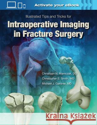 Illustrated Tips and Tricks for Intraoperative Imaging in Fracture Surgery Gardner, Michael J. 9781496328960
