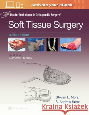 Master Techniques in Orthopaedic Surgery: Soft Tissue Surgery Moran, Steven 9781496329004 LWW