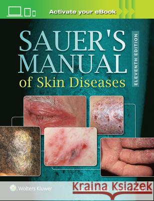 Sauer's Manual of Skin Diseases John C. Hall Brian J. Hall 9781496329936 LWW