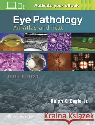 Eye Pathology: An Atlas and Text Ralph C. Eagle 9781496337177 LWW