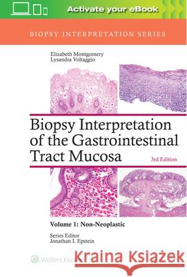 Biopsy Interpretation of the Gastrointestinal Tract Mucosa: Volume 1: Non-Neoplastic Elizabeth A. Montgomery Lysandra Voltaggio 9781496337276 Lippincott Williams and Wilkins