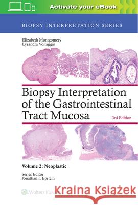 Biopsy Interpretation of the Gastrointestinal Tract Mucosa: Volume 2: Neoplastic Elizabeth A. Montgomery Lysandra Voltaggio 9781496337313 LWW