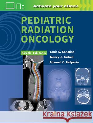 Pediatric Radiation Oncology Constine, Louis S. 9781496342867 Wolters Kluwer Health (LWW)