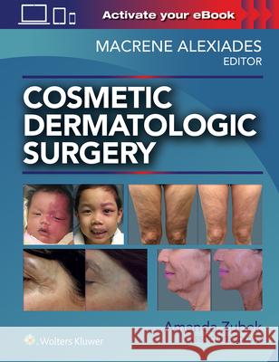 Cosmetic Dermatologic Surgery Macrene Alexiades 9781496344168 LWW