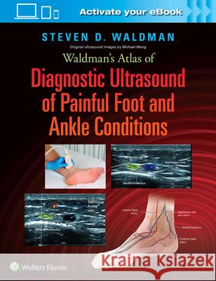 Waldman's Atlas of Diagnostic Ultrasound of Painful Foot and Ankle Conditions Steven Waldman 9781496345462