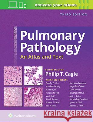 Pulmonary Pathology: An Atlas and Text Philip T. Cagle 9781496346094 LWW