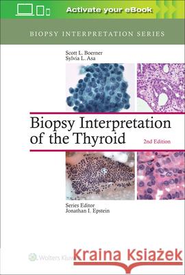 Biopsy Interpretation of the Thyroid Scott L. Boerner Sylvia L. Asa 9781496355850 LWW