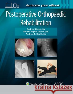 Postoperative Orthopaedic Rehabilitation: Print + eBook Green, Andrew 9781496360281 LWW