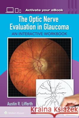 The Optic Nerve Evaluation in Glaucoma: An Interactive Workbook Lifferth, Austin 9781496363138 LWW