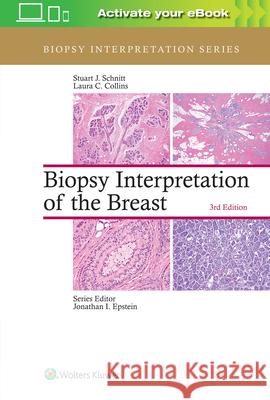 Biopsy Interpretation of the Breast Stuart J. Schnitt Laura C. Collins 9781496365750