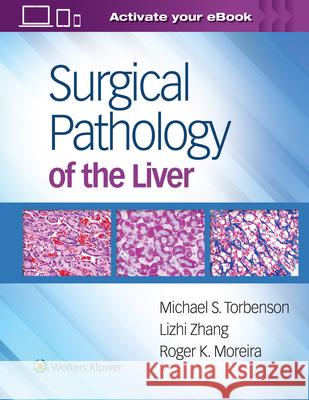 Surgical Pathology of the Liver Michael S. Torbenson Lizhi Zhang Roger K. Moreira 9781496365798