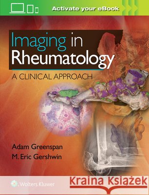 Imaging in Rheumatology: A Clinical Approach Greenspan, Adam 9781496367631