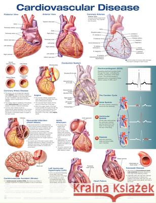 Cardiovascular Disease  Anatomical Chart Company 9781496369796 