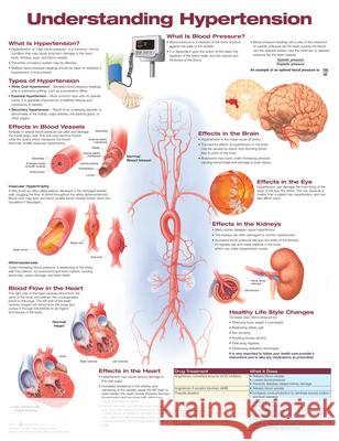 Understanding Hypertension  Anatomical Chart Company 9781496369819