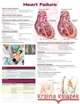 Heart Failure  Anatomical Chart Company 9781496369963 