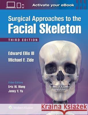 Surgical Approaches to the Facial Skeleton Edward Elli Michael F. Zide 9781496380418 Lippincott Williams and Wilkins