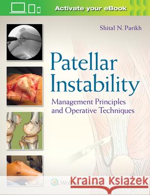 Patellar Instability: Management Principles and Operative Techniques Shital Parikh 9781496380821 Lippincott Williams and Wilkins