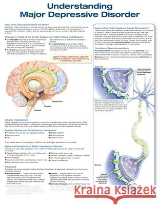Understanding Depression Anatomical Chart Company   9781496384690 Lippincott Williams and Wilkins