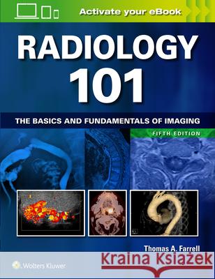 Radiology 101: The Basics and Fundamentals of Imaging Thomas A. Farrell 9781496392985 LWW