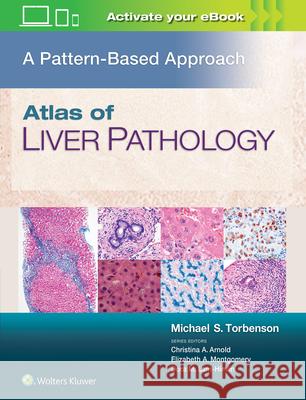 Atlas of Liver Pathology: A Pattern-Based Approach Torbenson, Michael 9781496396976