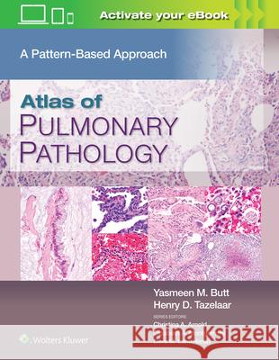 Atlas of Pulmonary Pathology: A Pattern Based Approach Butt, Yasmeen Mahmood 9781496397553 LWW