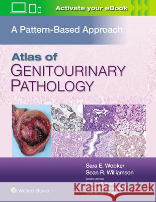 Atlas of Genitourinary Pathology: A Pattern Based Approach Sara E. Wobker Sean R. Williamson 9781496397669 LWW