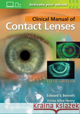 Clinical Manual of Contact Lenses Edward S. Bennett Vinita Allee Henry 9781496397799