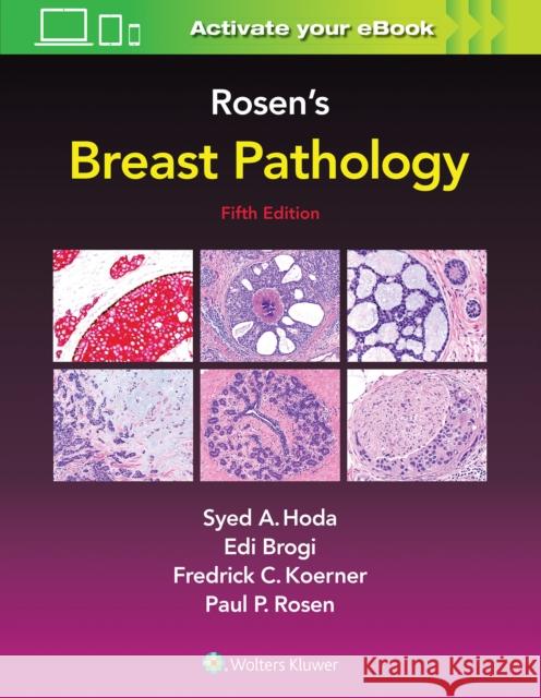 Rosen's Breast Pathology Syed Hoda 9781496398918