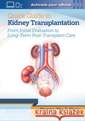 Quick Guide to Kidney Transplantation Pham, Phuong-Chi T. 9781496399649 Lippincott Williams and Wilkins