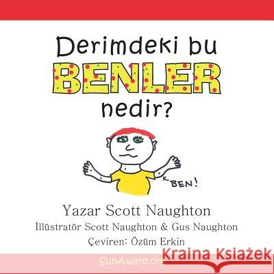 Derimdeki Bu Benler Nedir? Scott Naughton 9781496914972 Authorhouse