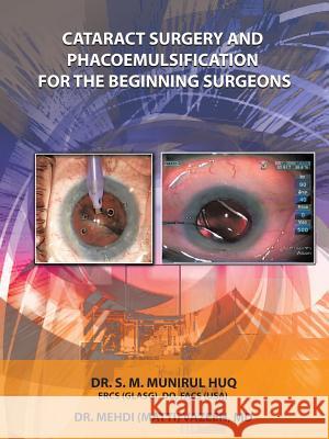 Cataract Surgery And Phacoemulsification For The Beginning Surgeons Dr S. M. Munirul Huq Dr Mehdi Vazeen 9781496944139 Authorhouse