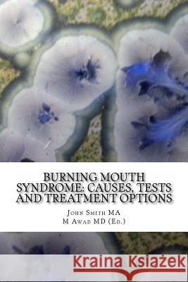 Burning Mouth Syndrome: Causes, Tests and Treatment Options John Smit M. Awa 9781497363212 Createspace