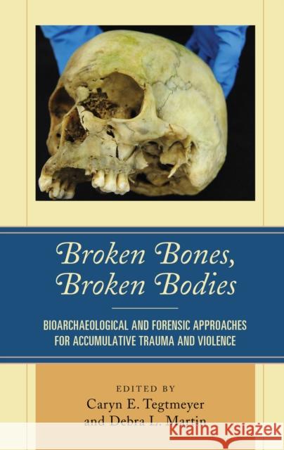Broken Bones, Broken Bodies: Bioarchaeological and Forensic Approaches for Accumulative Trauma and Violence Debra L. Martin Caryn E. Tegtmeyer Petra Banks 9781498547147 Lexington Books