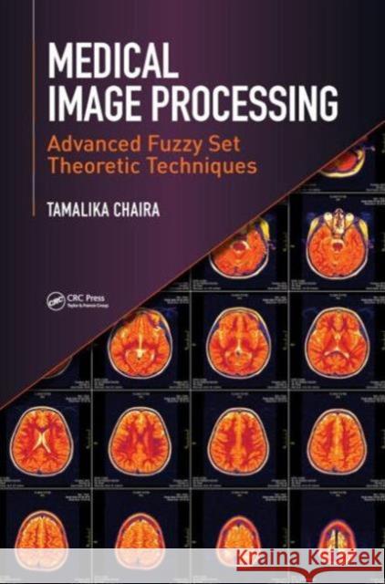 Medical Image Processing: Advanced Fuzzy Set Theoretic Techniques Chaira, Tamalika 9781498700450 CRC Press