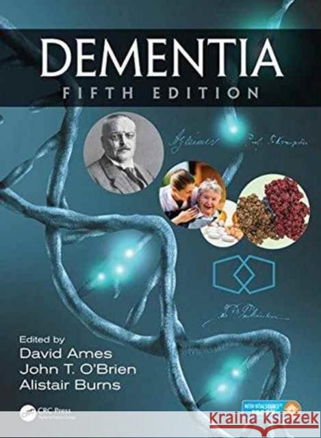 Dementia David Ames John T. O'Brien Alistair Burns 9781498703109