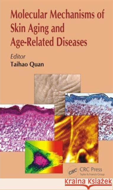 Molecular Mechanisms of Skin Aging and Age-Related Diseases Taihao Quan 9781498704649 CRC Press