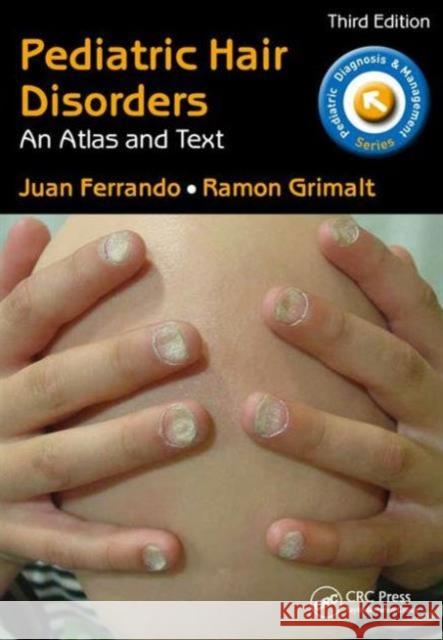 Pediatric Hair Disorders: An Atlas and Text, Third Edition Juan Ferrando Ramon Grimalt 9781498707770 CRC Press