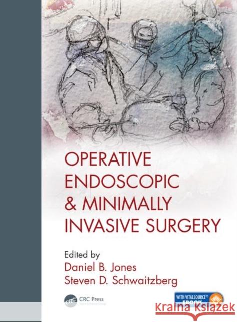 Operative Endoscopic and Minimally Invasive Surgery Steven Schwaitzberg Daniel B. Jones  9781498708302