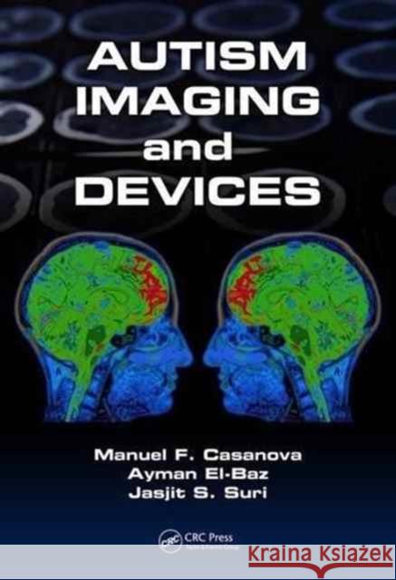 Autism Imaging and Devices Manual F. Casanova Ayman El-Baz Jasjit S. Suri 9781498709811