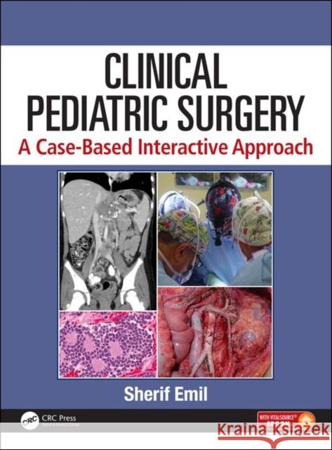 Clinical Pediatric Surgery: A Case-Based Interactive Approach [With eBook] Emil, Sherif 9781498710336 Productivity Press
