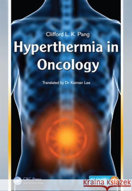 Hyperthermia in Oncology Pang Clifford L K 9781498714464 CRC Press